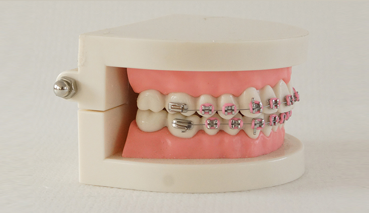 TM-B9-01 Ortho Metal Brcker